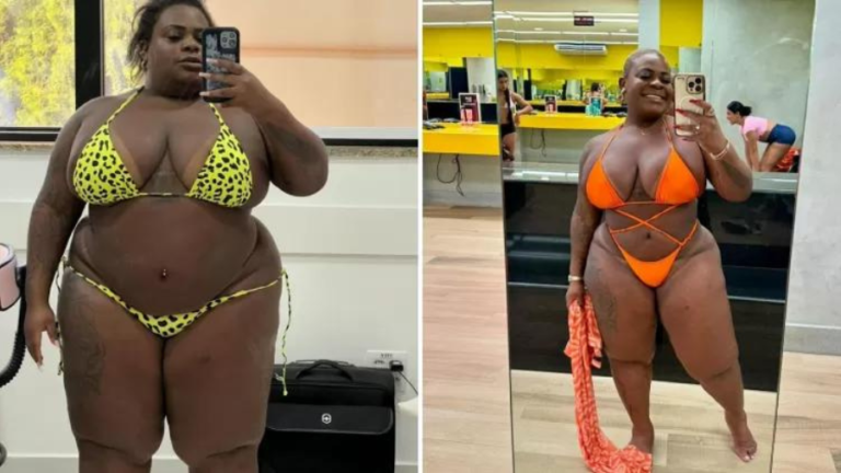 Jojo Todynho mostra antes e depois de perda de 53 kg após bariátrica