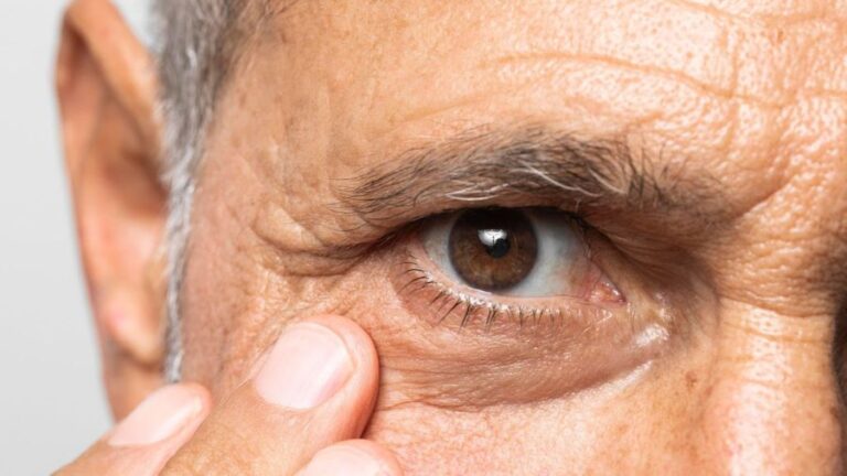 Retinopatia diabética, complicação do diabetes que pode causar cegueira